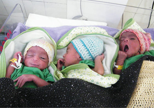 Geburt von Drillingen im Krankenhaus Attat in Äthiopien